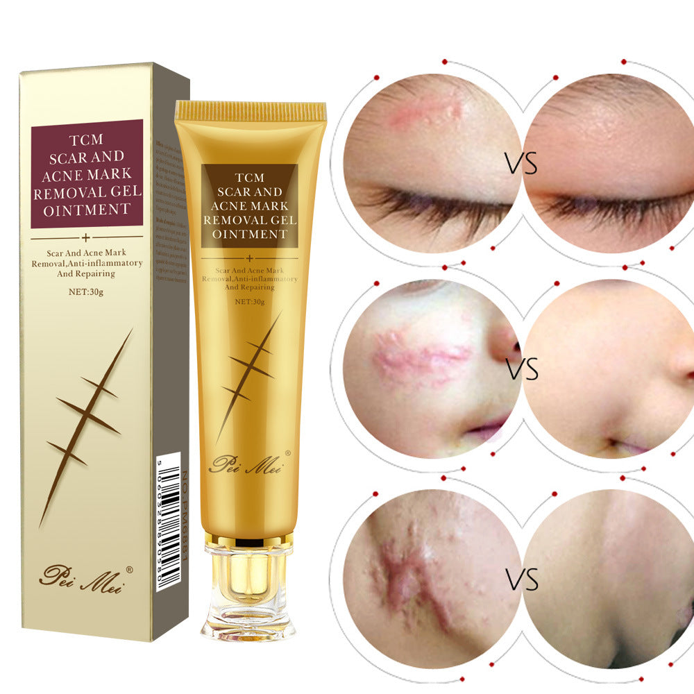 Scar Cream